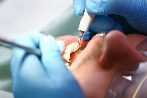 Best Emergency Care for Gum Disease in St Maries, ID